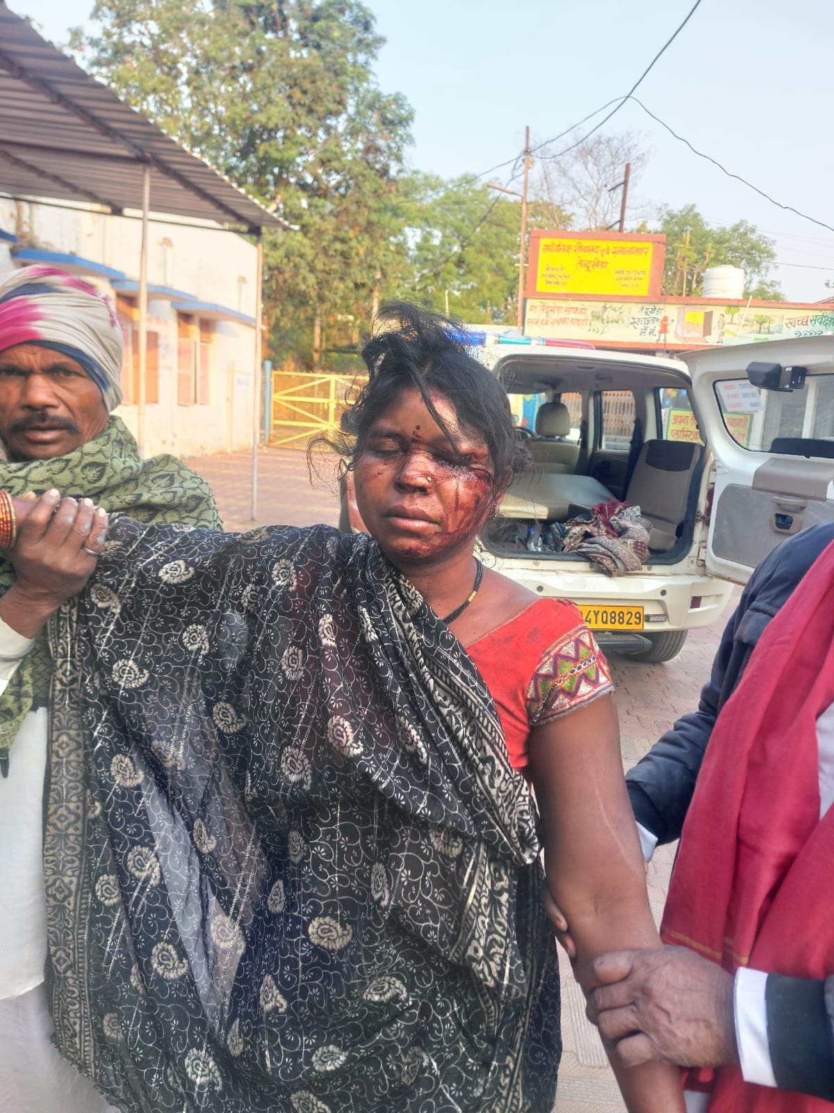 *सोते समय पत्नी पर पति का जानलेवा हमला, डायल-112 ने बचाई जान*